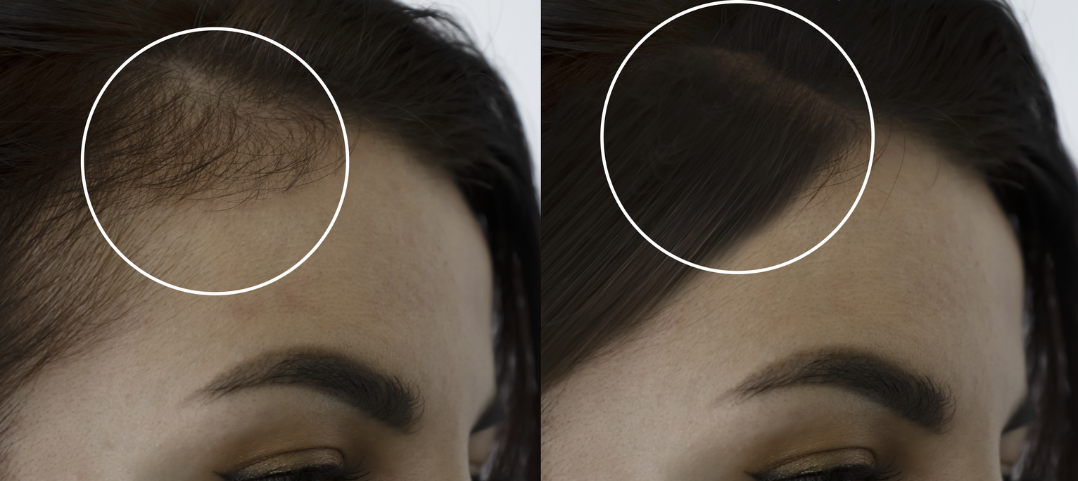 Side Before & After