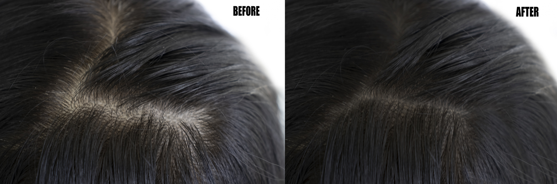 before and after hair topper