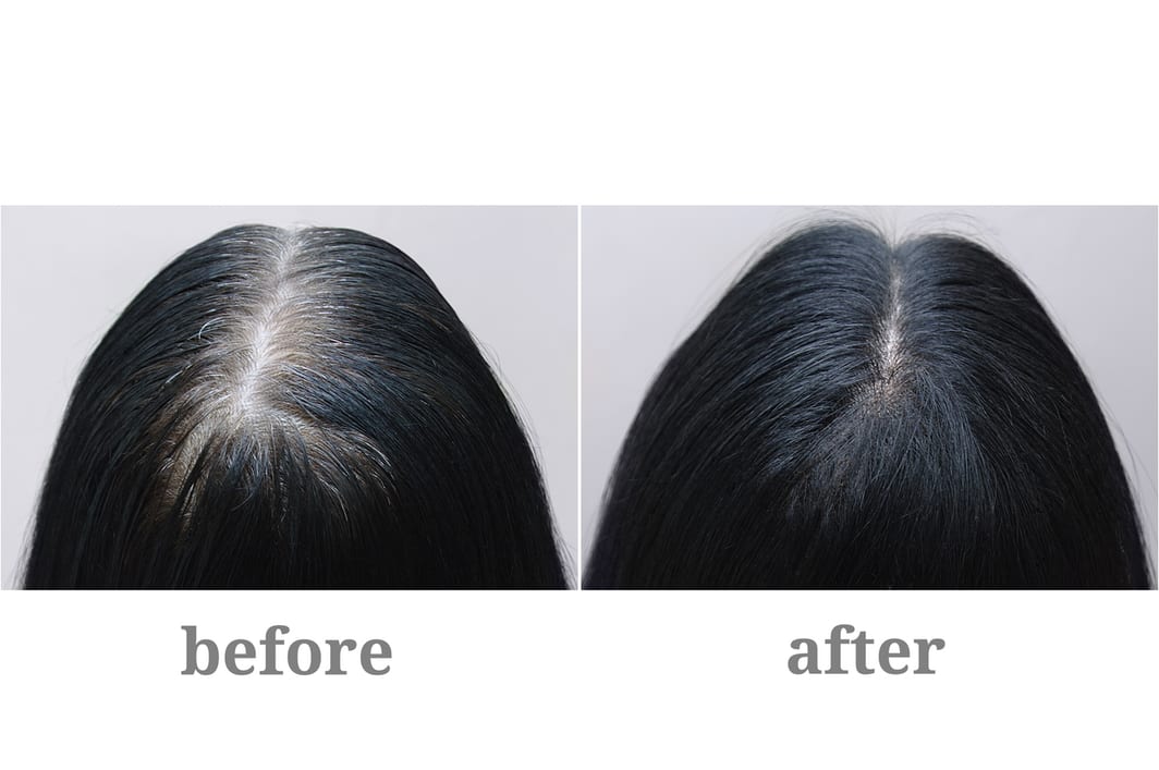 before and after