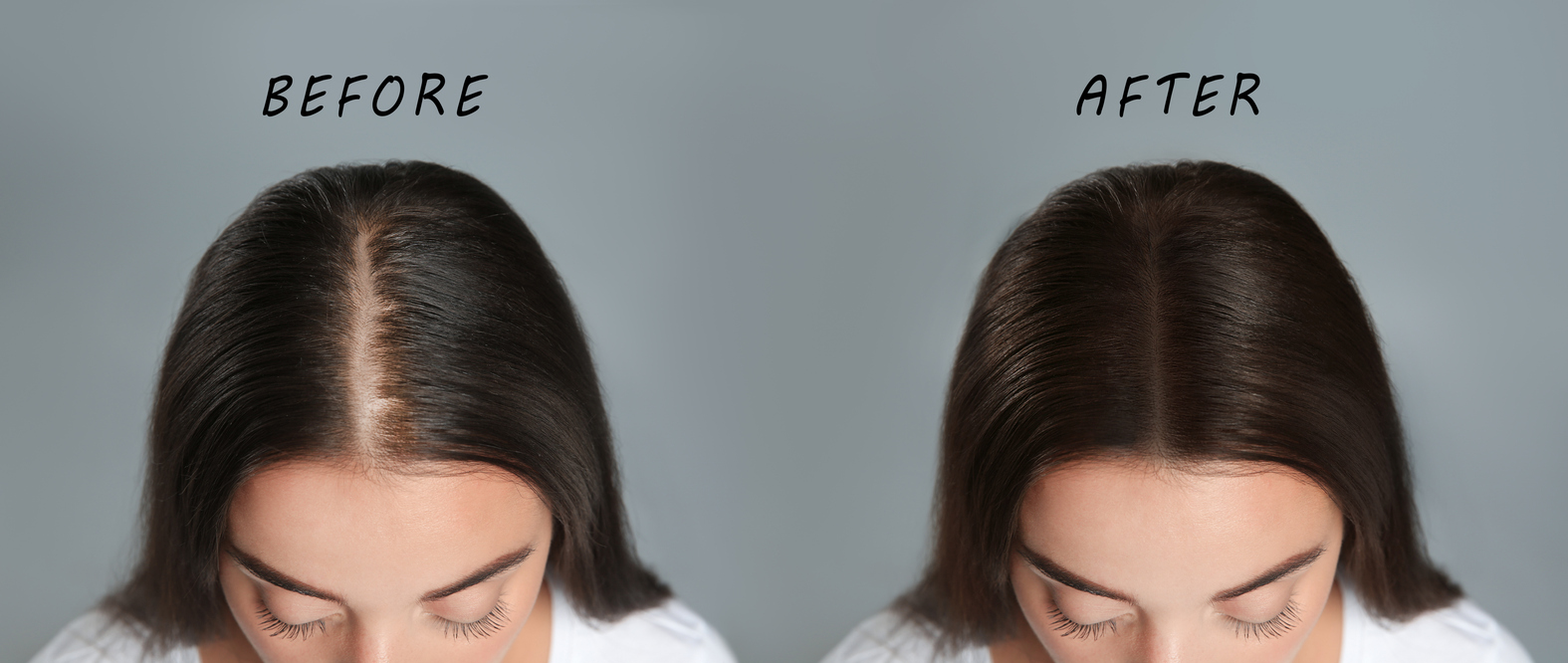 before and after