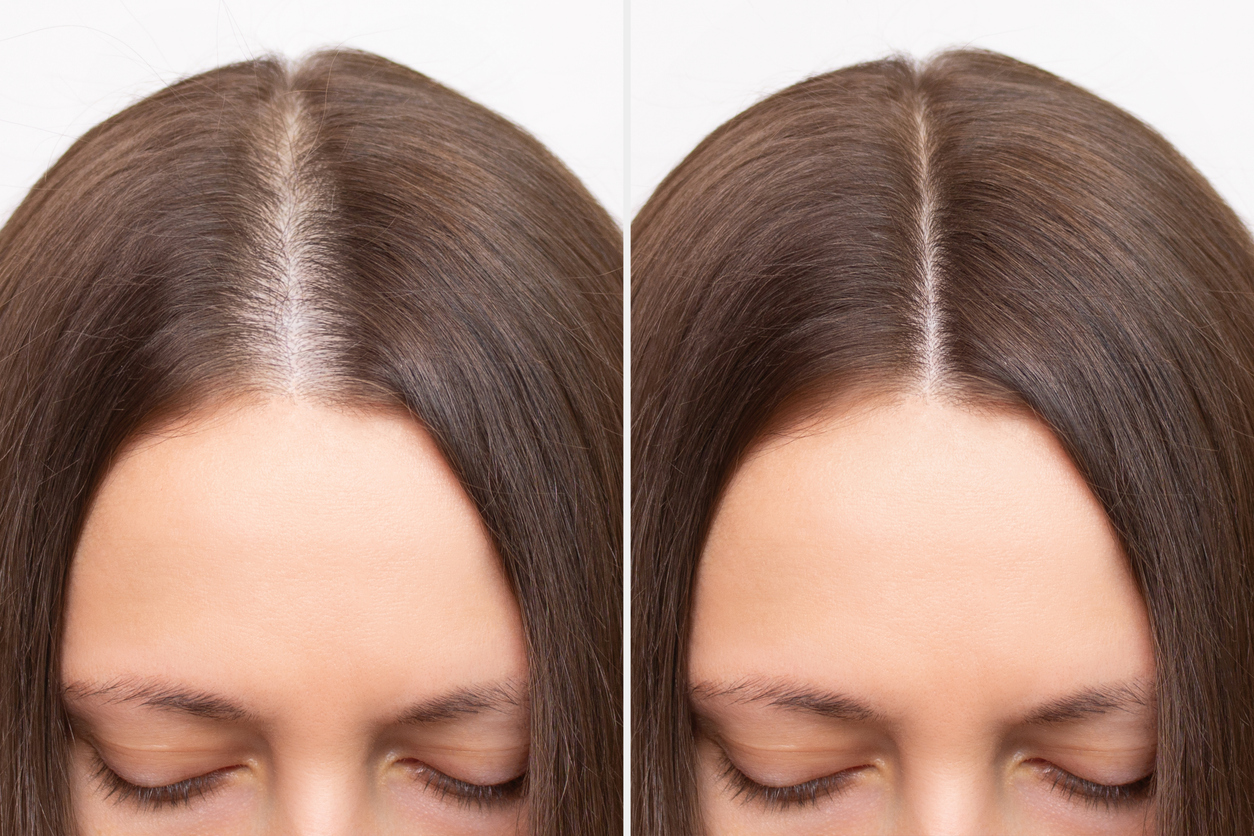 before and after hair topper